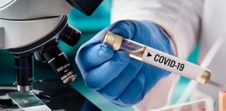 Investigación OMS coronavirus Colombia