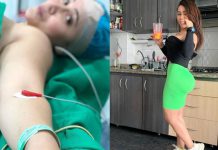 procedimiento quirúrgico que se hizo Yina Calderón para ser la nueva Barbie Humana