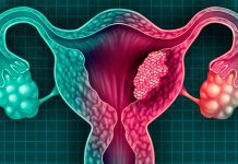 Además, es importante que las mujeres estén informadas sobre los factores de riesgo y los síntomas del cáncer de cuello uterino, y que consulten a su médico si notan cualquier cambio en su cuerpo.